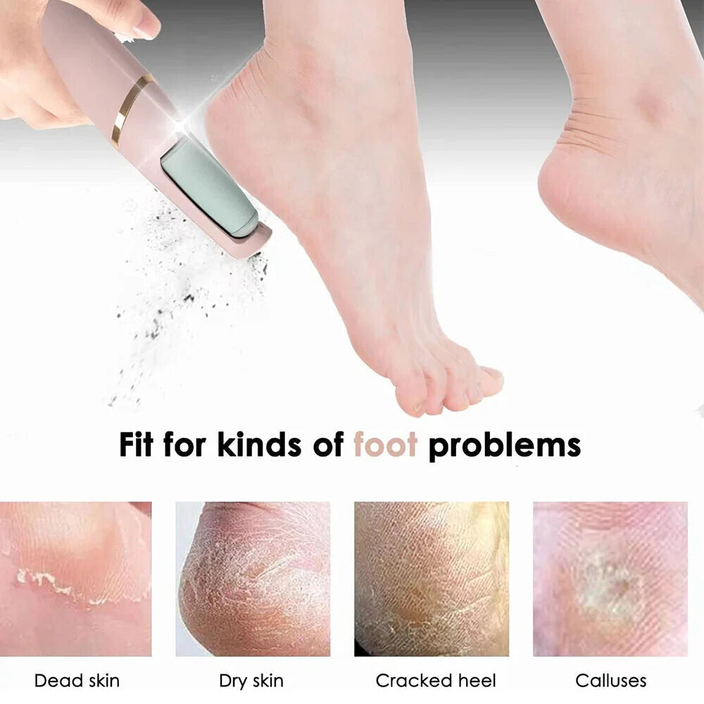 Electric Pedicure Machine Foot File Dead Skin Remover