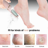 Electric Pedicure Machine Foot File Dead Skin Remover